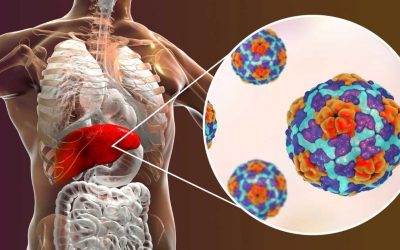 How to Prevent Hepatitis? Check out the Types and Treatments