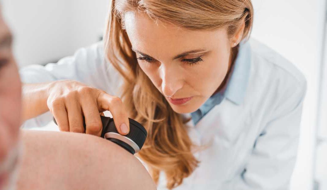 Penyebab Kanker Kulit Melanoma Mandira Distra