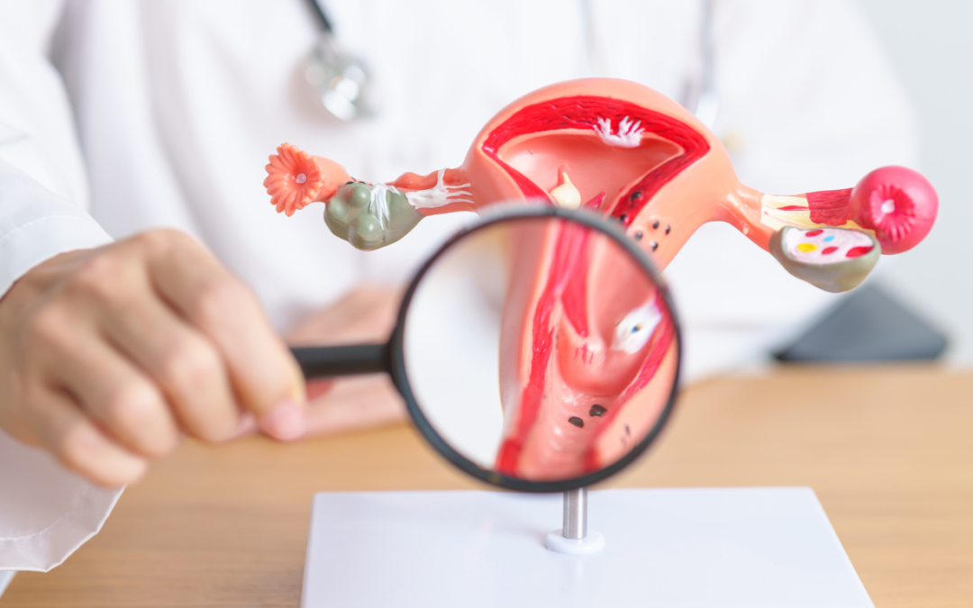 perbedaan pap smear dan hpv dna - Mandira Distra